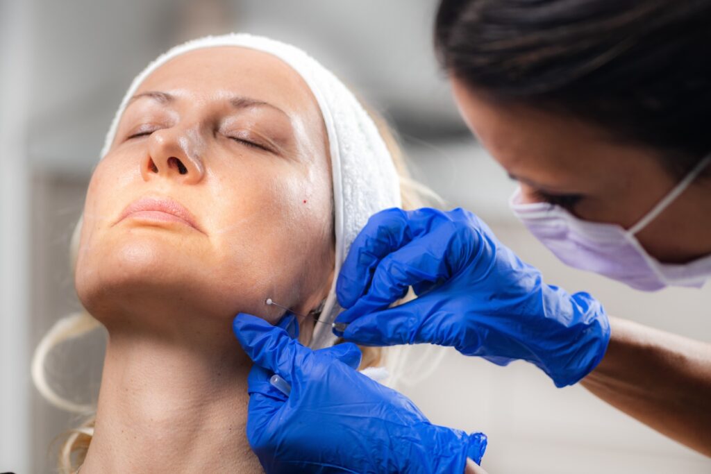 A provider, wearing surgical gloves, carefully places PDO threads along a patient's jawline. PDO threads are one of the most popular sagging skin treatments in the Arboretum area.